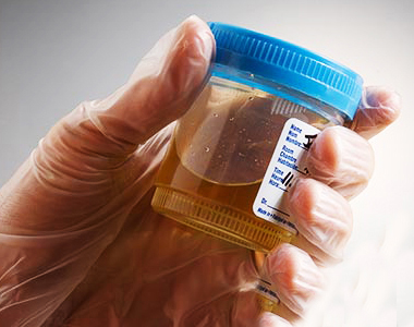 Vazopressin hormonunun vəsilə olması ilə sidik miqdarı azaldılmış və bədənə su qazandırılmış olur.